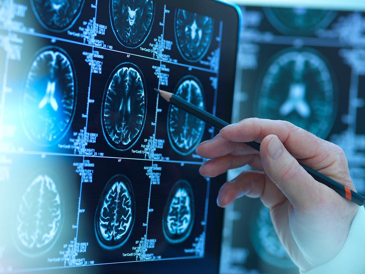 How a Baby’s Brain Grows in the First Years of Life