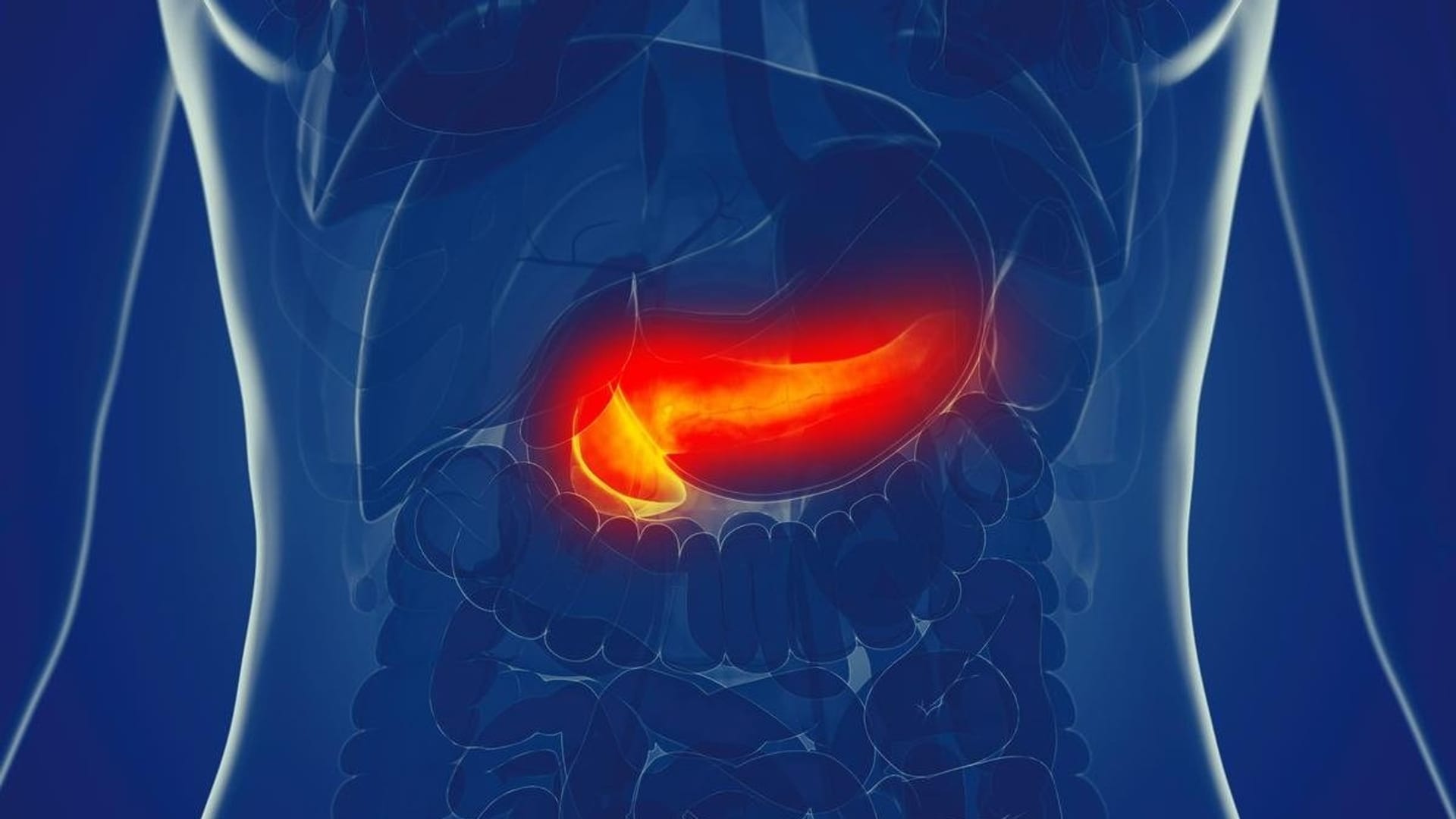 FDA Green Lights Expanded Access to Pancreatic Cancer Drug, Daraxonrasib