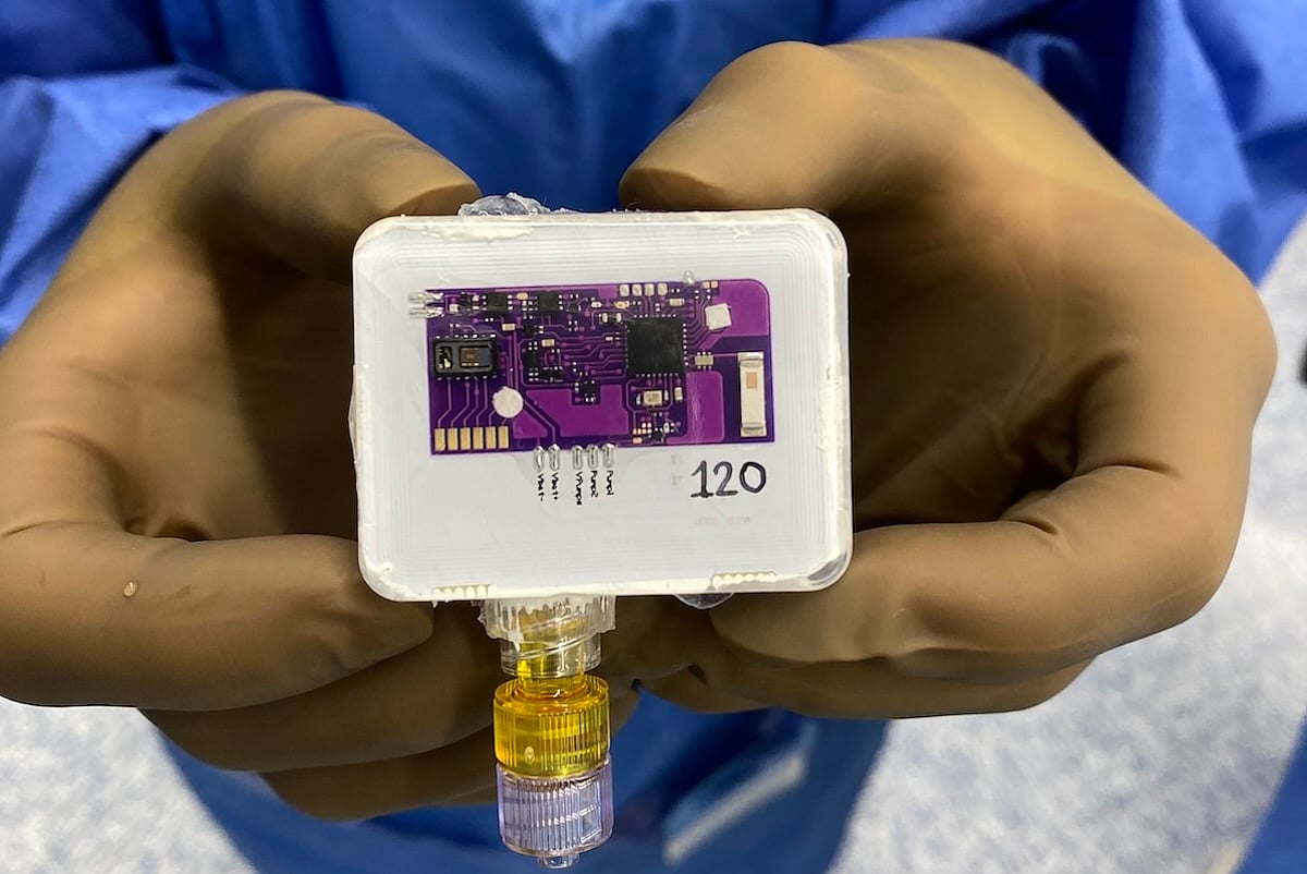 Implant Might Prevent Opioid Overdose
