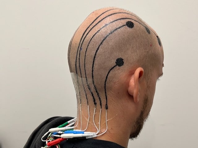 Temporary Scalp Tattoo Can Track Your Brainwaves