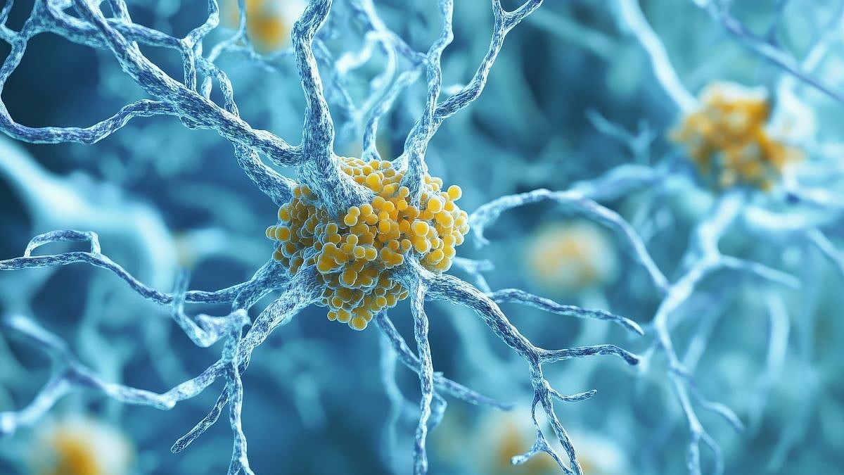A Common Trait Between Newborns And Alzheimer’s Patients?