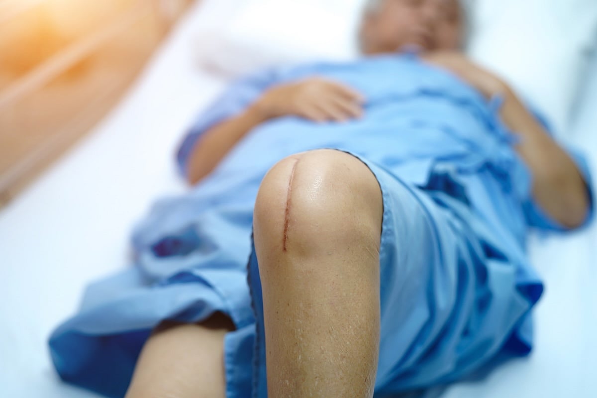 Spouses Also Benefit From Partner's Knee/Hip Replacement