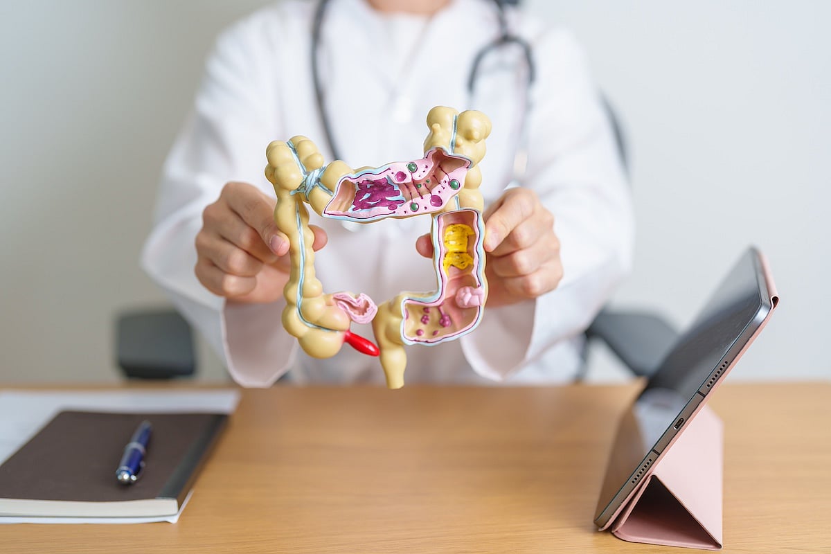 Early Detection of Colon Cancer Is Critical for Women