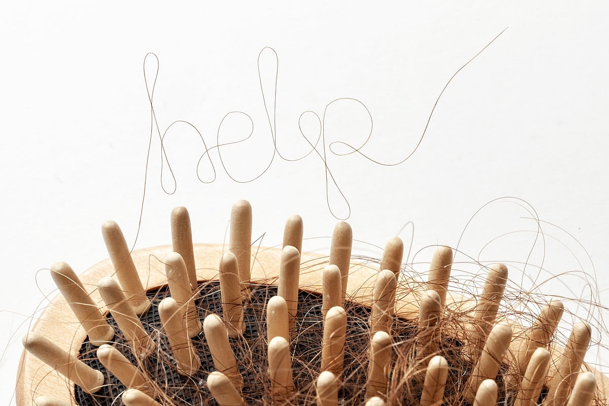 Rare Hair Loss Condition Can Be Treated With Low Doses Of Antibiotic