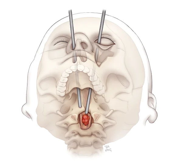 blog image