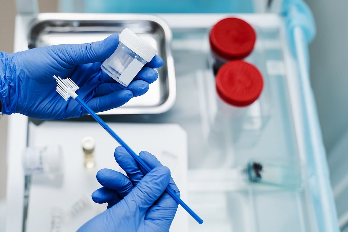 At-Home HPV Testing Boosts Cervical Cancer Screening Rates