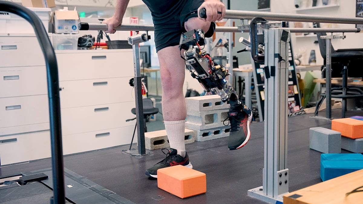 Bionic Knee Allows Better Movement For Amputees