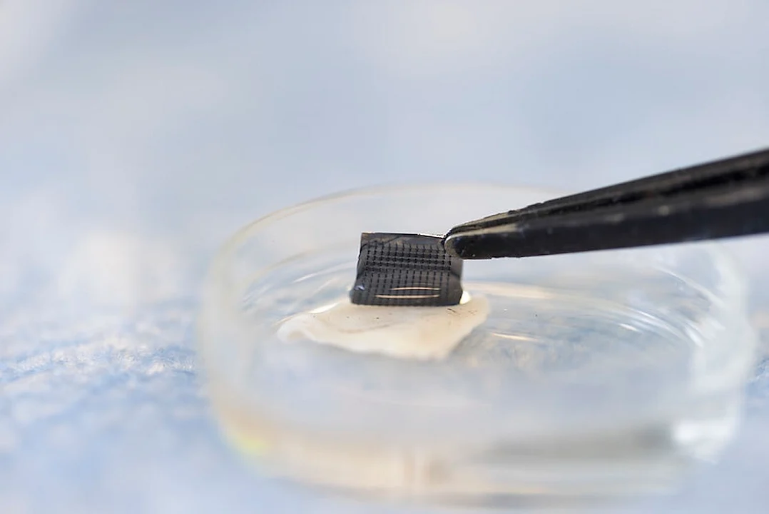 Coming Soon: An At-Home Patch to Spot Skin Cancers?