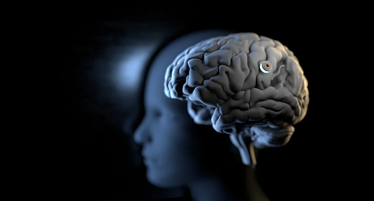 New Brain Implant Could Let People Speak Just by Thinking Words
