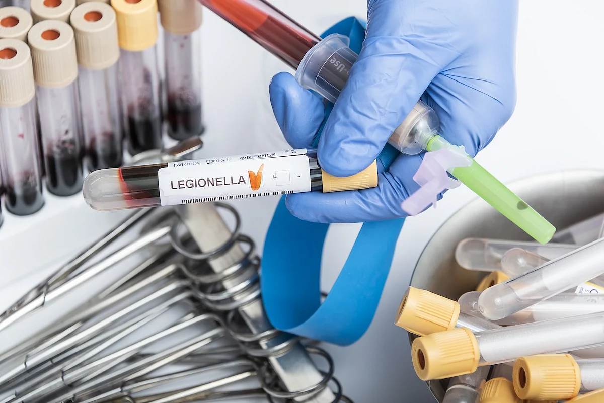 NYC Legionnaires’ Outbreak: Fourth Death Confirmed, 101 Sickened