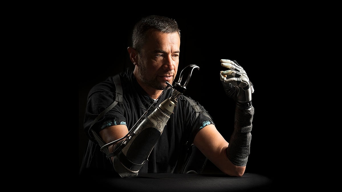Improved Bionic Hand Has A Mind Of Its Own, Researchers Say