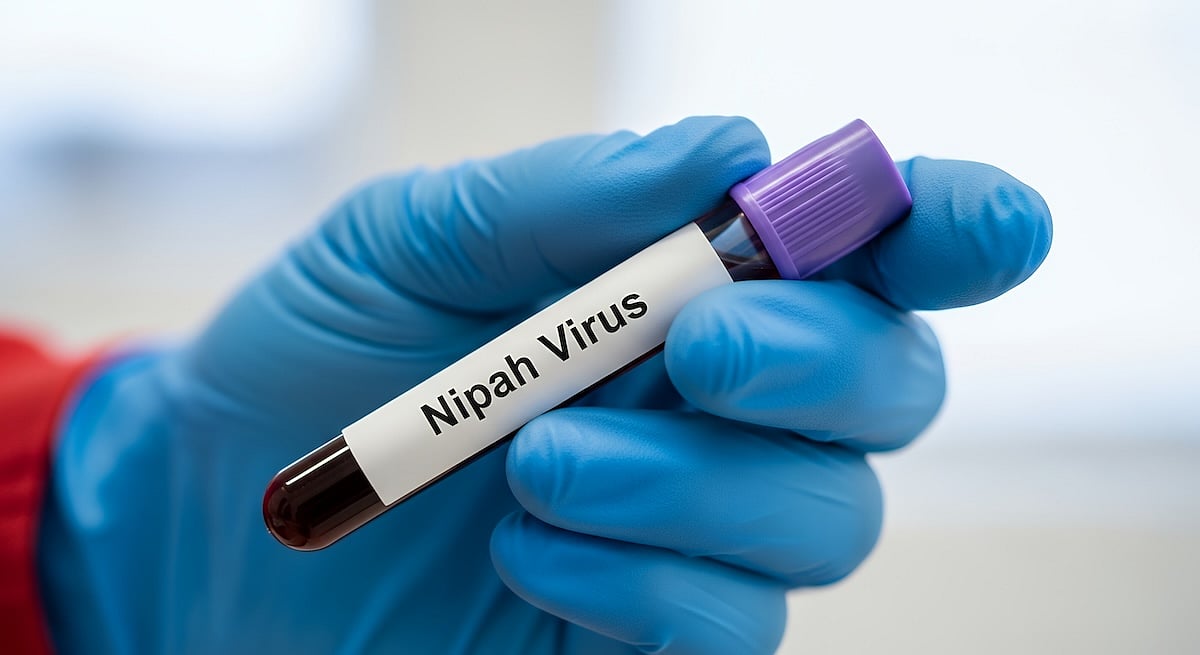 What to Know About Nipah Virus After New Cases in India
