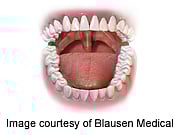 New Strep Throat Guidelines Tackle Antibiotic Resistance