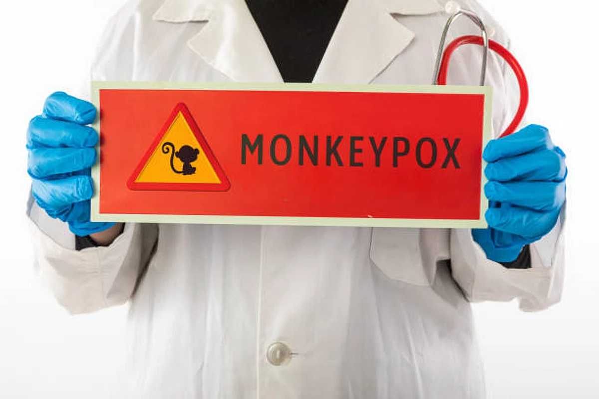 Monkeypox Updates: कोरोना के बाद फिर बढ़ी भारत की चिंता, राजस्थान सरकार अलर्ट