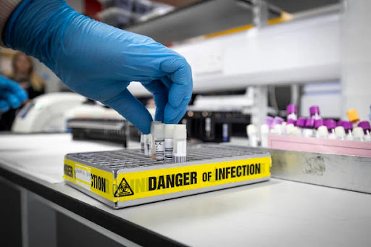 Zombie Virus News: झील के नीचे मिला 48 हज़ार साल से भी पुराना वायरस