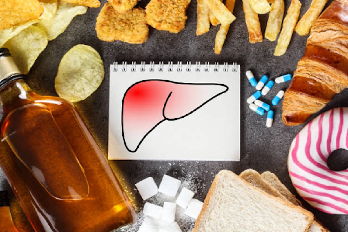 Fatty Liver Disease: लीवर में फैट बन सकता है मांसपेशियों में कमज़ोरी का कारण