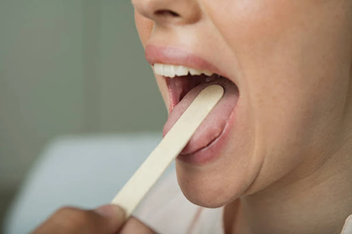 Signs Of High Cholesterol: जीभ पर नज़र रखनी है जरूरी?