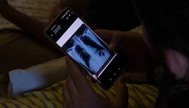 Digital medicine has been growing in India during the pandemic. Internet strength is a crucial component to enable this. The adoption of 5G will require at least 50-60 per cent of towers to be connected by fibre - ideally before the launch of the new technology.