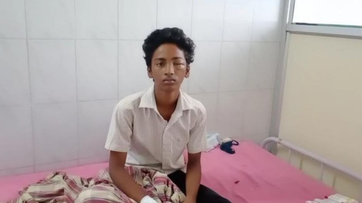 இறுதி ஊர்வலத்தில் வெடித்த நாட்டுவெடியால் சிறுவனுக்கு நேர்ந்த சோகம்... நடந்தது என்ன?