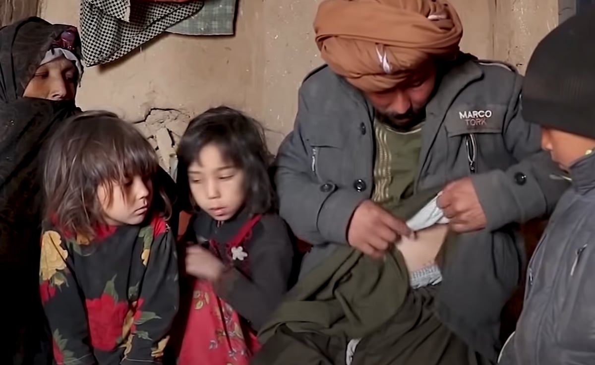 கடுமையான பஞ்சத்தில் ஆப்கானிஸ்தான்; கிட்னியை விற்று வாழ்க்கையை ஓட்டும் ஆப்கானியர்கள்!