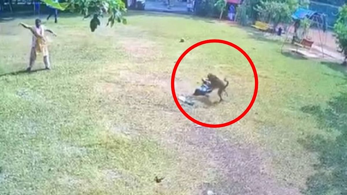 சிறுமியைக் கடித்துக் குதறிய வளர்ப்பு நாய்.. உரிமையாளரை எச்சரித்த போலிஸ் : நடந்தது என்ன?