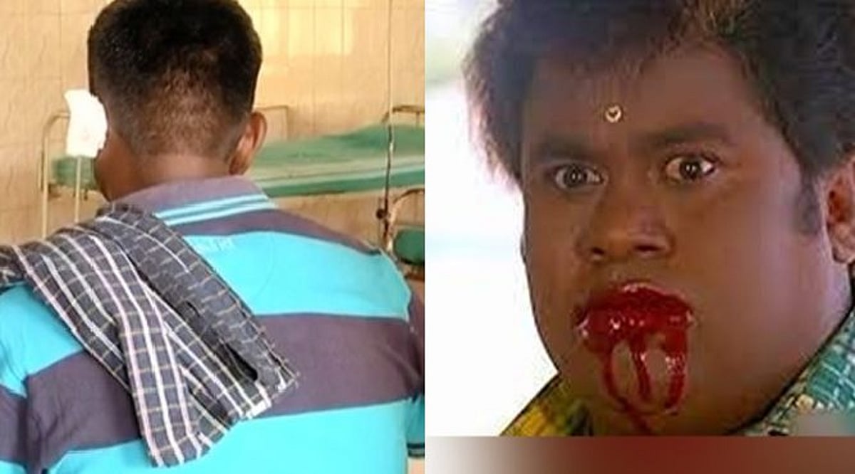 “என் மனைவி பிரிந்ததற்கு நீ தான் காரணம்”: குடிபோதையில் பக்கத்து வீட்டுக்காரர் காதை கடித்து துப்பிய இளைஞர்!