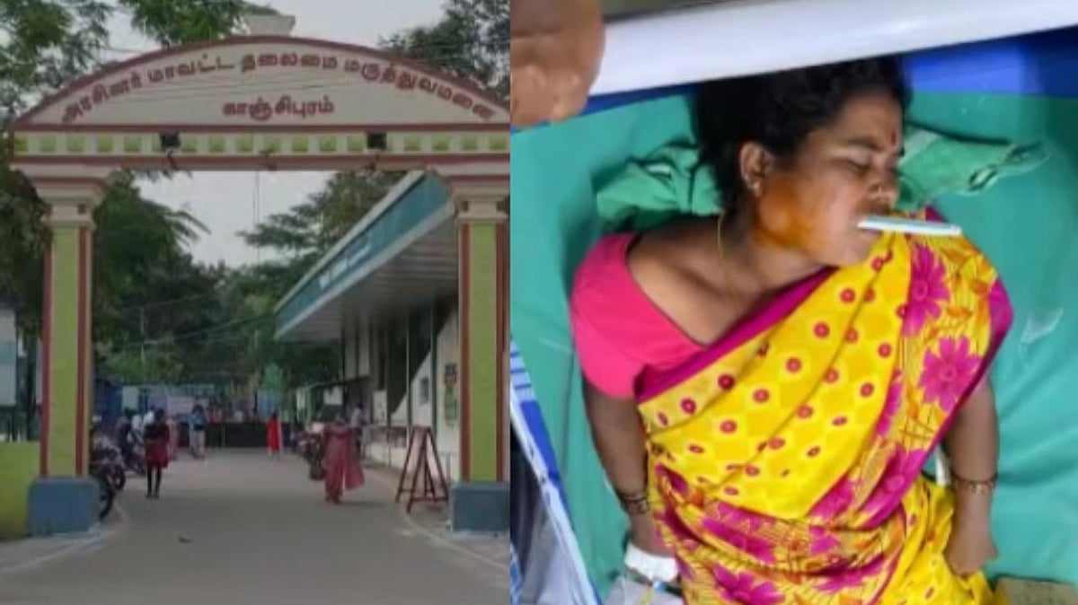 பல் துலக்கும்போது பெண்ணின் வாயில் சிக்கிய டூத் பிரஷ்; காஞ்சியில் வெற்றிகரமாக அகற்றிய அரசு மருத்துவர்கள்!