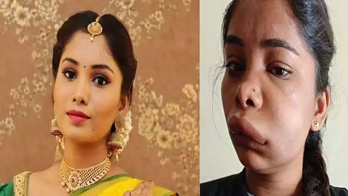 பல் வலிக்கு சிகிச்சை எடுத்தபோது நடந்த கொடூரம்.. கண்ணீர் விட்டு கதறும் பிரபல நடிகை!