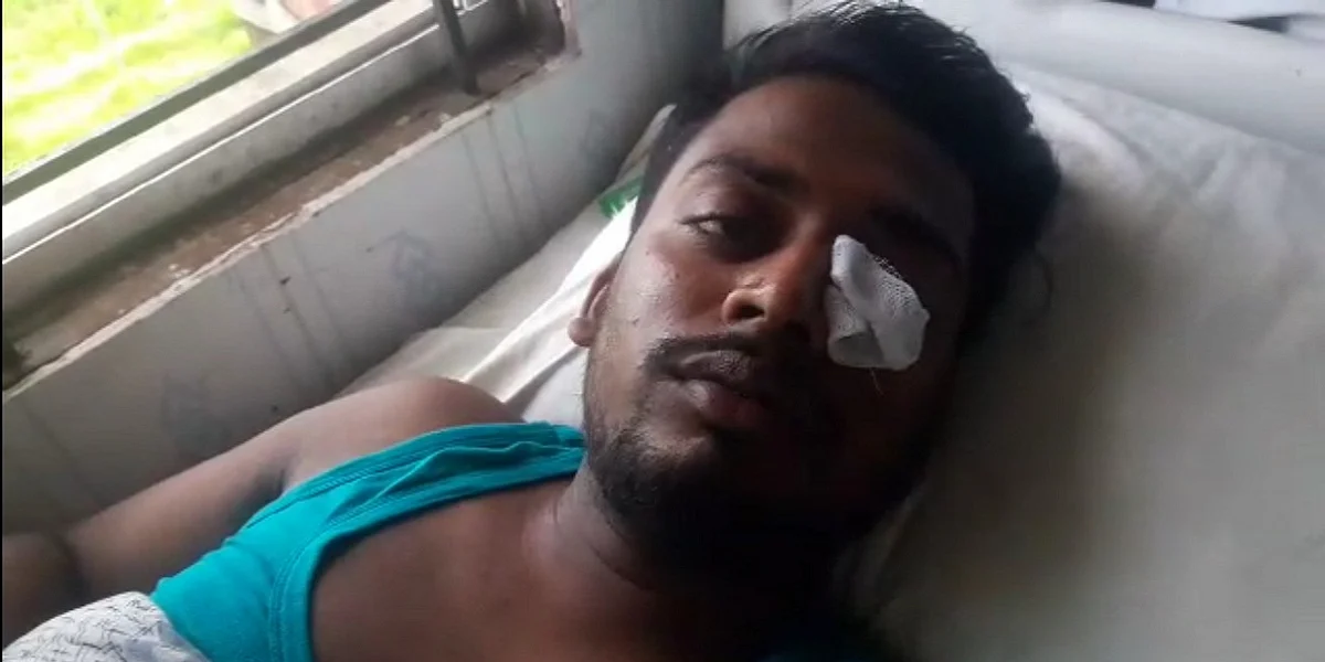 আহত আহসান হাবিব।