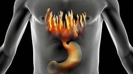 நெஞ்சு எரிச்சலுக்கான காரணமும் தீர்வும் தெரியுமா?