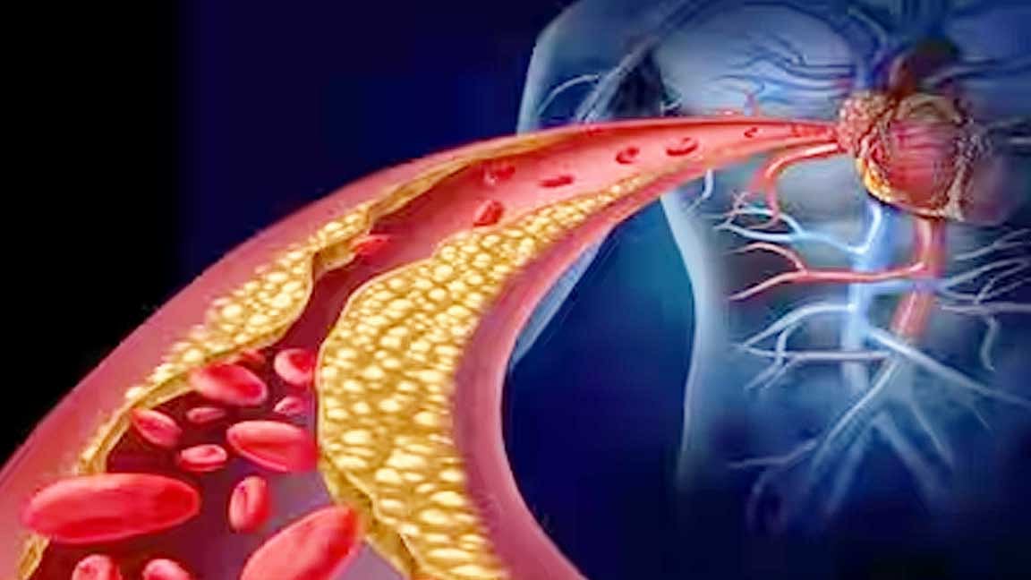 கொலஸ்ட்ரால் குறைய எளிய வழிமுறைகள்! 