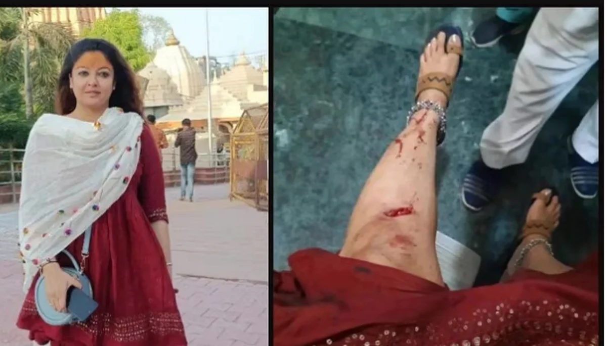 `விபத்து நடந்துவிட்டது; தப்பித்துவிட்டேன்'- படுகாயமடைந்த பிரபல நடிகை உருக்கம்