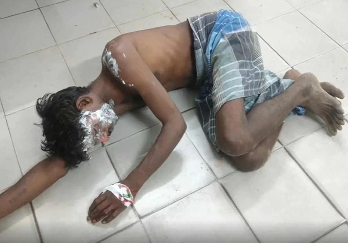 மது போதையில் தொடர்ந்து டார்ச்சர்… கொதிக்கும் ரசத்தை கணவன் மீது ஊற்றிய மனைவி: விழுப்புரத்தில் அதிர்ச்சி!