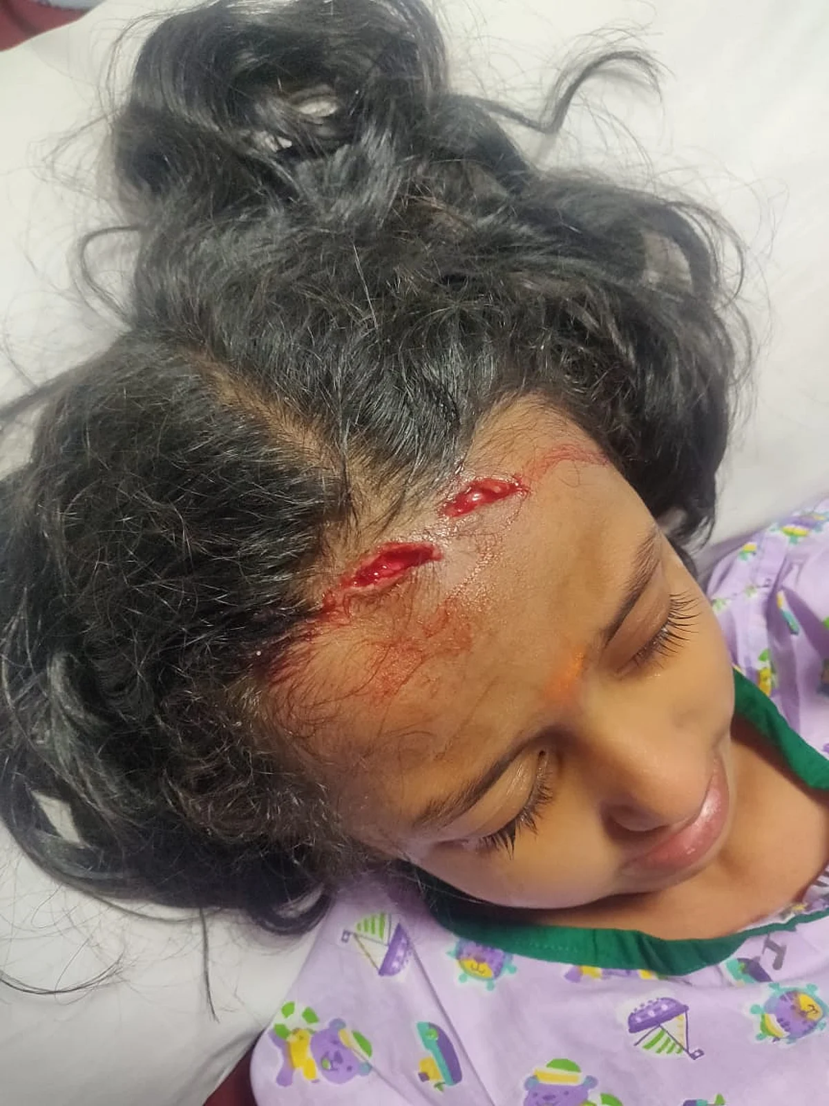 வகுப்பறையில் இடிந்து விழுந்த பால்சீலிங்; காயத்துடன் உயிர் தப்பிய மாணவிகள்: தனியார் பள்ளியில் நடந்த சோகம்