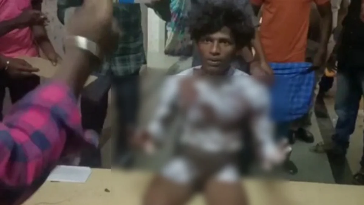 ஆசை வார்த்தை கூறி சிறுமியை அழைத்து சென்ற இளைஞர்: தீக்காயங்களுடன் மருத்துவமனையில் அனுமதி!