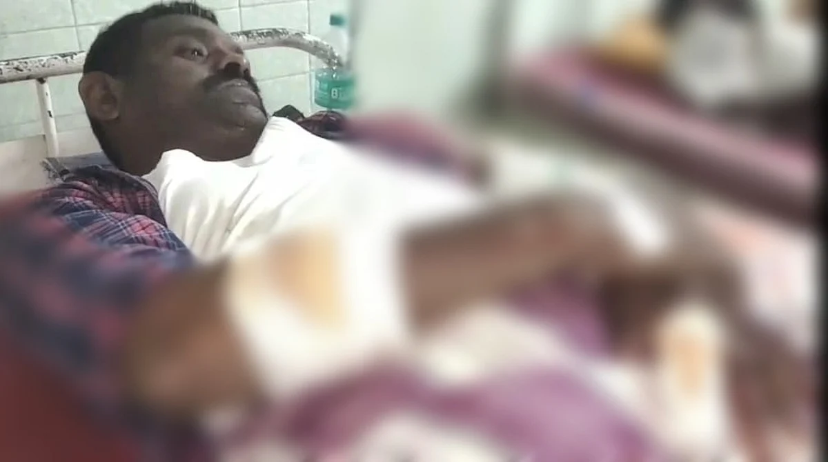 கையில் காயத்துடன் மோகன்