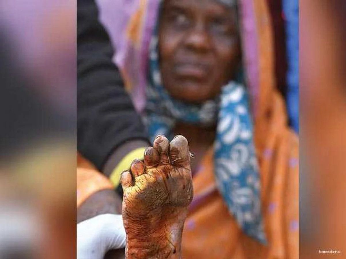 ‘கால்’ புரட்சி