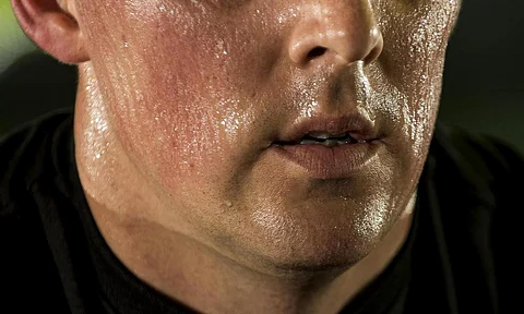is excessive sweating good or bad