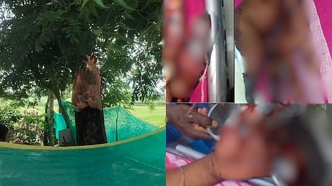 “வெட்டப்பட்ட தொழிலாளியின் விரல்கள்” - மரத்தில் கட்டி வைத்து செய்த சித்ரவதை.. வீட்டிற்கு திரும்பியவருக்கு நடந்த கொடுமை!