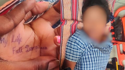 “my life full damage.. சிறுமி கையில் இருந்த வாசகம்” - கையை அறுத்துக்கொண்டு மண்ணெண்ணெய் குடித்த 12 வகுப்பு மாணவி!
