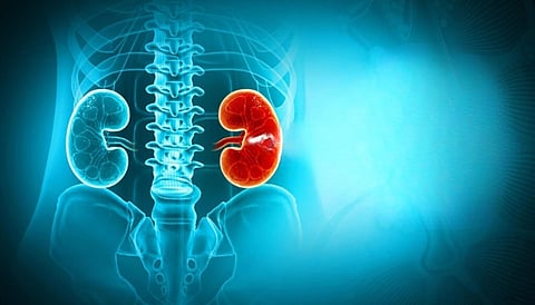 கிட்னி செயலிழப்பைத் தடுக்கும் 5 அதிசய உணவுகள்! சிறுநீரகக் கற்களை வேரோடு கரைக்க இதை மட்டும் குடிங்க