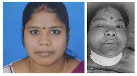 “17 வயது சிறுவனுடன் கள்ள தொடர்பில் இருந்த 37 வயது பெண்” - உல்லாசத்தில் இருந்ததை பார்த்த மாமியார்… கண்ணில் மிளகாய் பொடி தூவி கழுத்தை அறுத்த கொடூரம்!