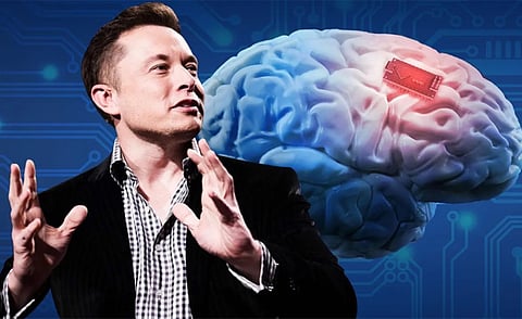 நினைத்தாலே நடக்கும் காலம் வந்தாச்சு! மனித மூளையில் சிப் வைத்தால் சூப்பர் மேனாக மாற முடியுமா?