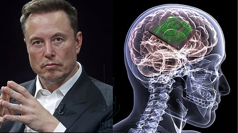 மனிதர்களா? நடமாடும் கணினிகளா? உங்கள் மூளையில் சிப் - எலான் மஸ்க்கின் அந்த மிரட்டும் ரகசியம்!