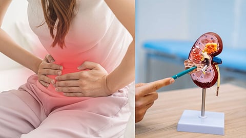 Urinary Tract Infection