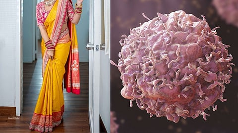 சேலை புற்றுநோய் 