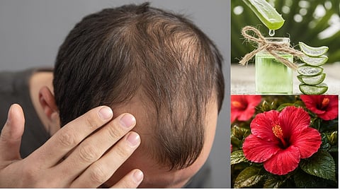 முடிகொட்டுதா? இத ட்ரை பண்ணுங்க