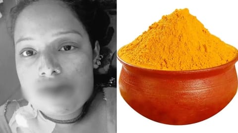 Turmeric poisoning case