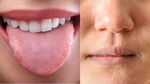 Facial health analysis