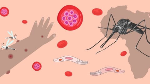 Malaria Symptoms
